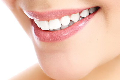 The image displays a close-up of a smiling person with fair skin, showcasing their teeth and lips.