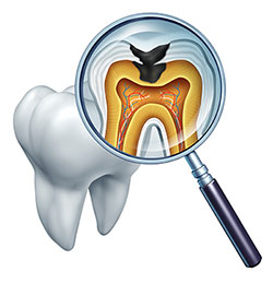 The image displays a magnified view of a tooth with its internal structure visible, including the root and pulp chamber, through a transparent glass or microscope. A magnifying glass is placed over the tooth, and the interior of the mouth appears in the background, showing the teeth and gums.