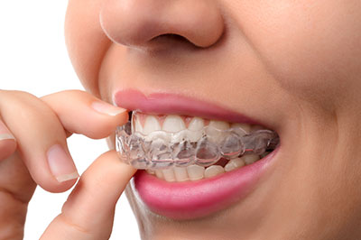 A woman adjusting her clear braces with a smile.