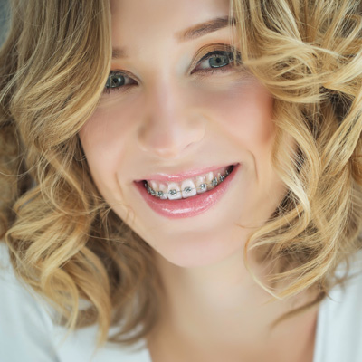 A woman with a smile, wearing braces and a white top.