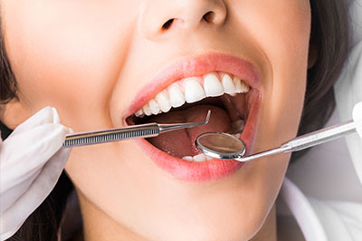 The image shows a person with an open mouth, receiving dental care as evidenced by the dental tools visible in their mouth.