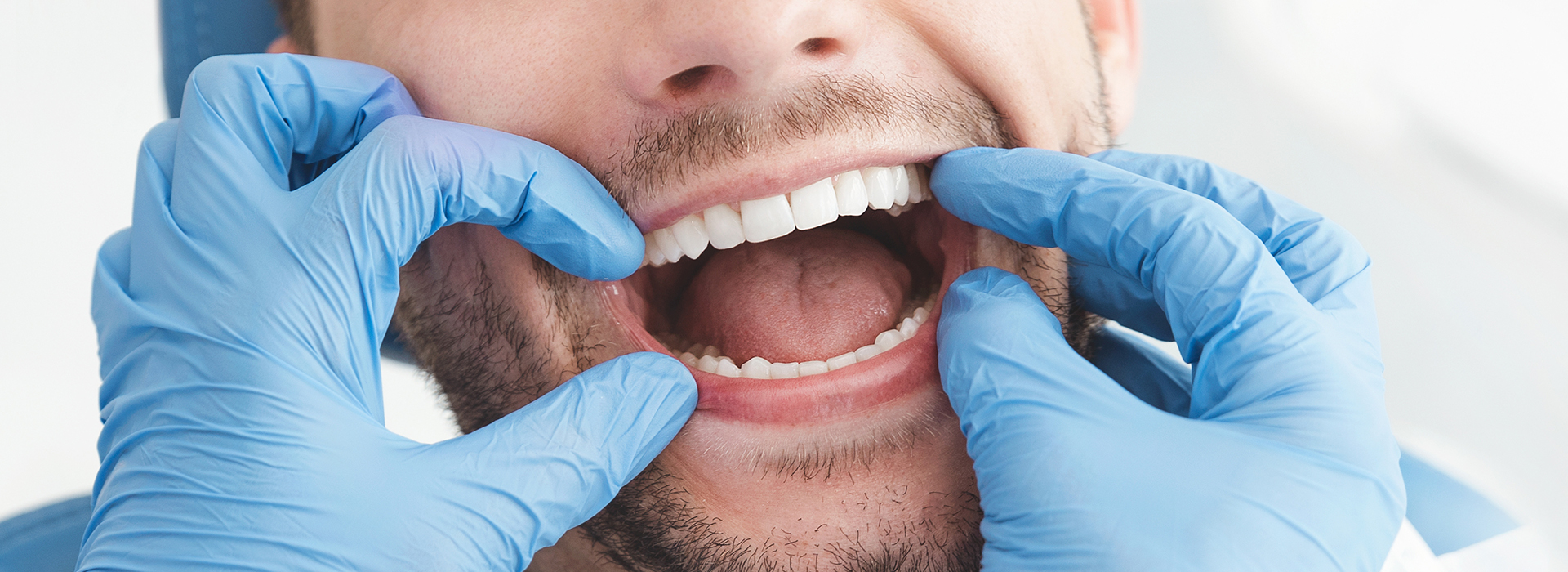 A man with a blue surgical gown and mask is smiling broadly, revealing his teeth, while holding a dental tool to his mouth.