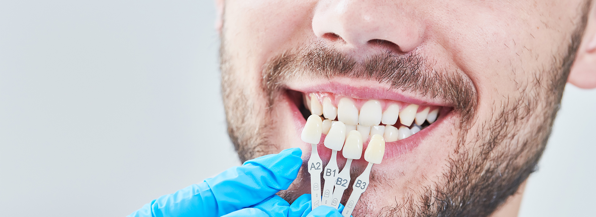 A man with a toothy smile, wearing a face mask and holding a dental implant in his hand.